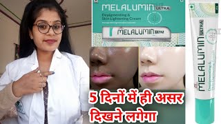 Melalumin Ultra Depigmenting Cream Uses amp Side effects in hindi  Melalumin Ultra skin cream uses [upl. by Adara]