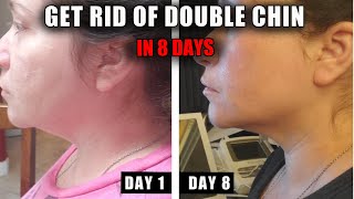 HOW TO GET RID OF A DOUBLE CHIN IN 8 DAYS  IT WORKS FAST [upl. by Ydissac375]