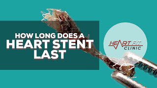 How long does a heart stent last [upl. by Anohsal530]