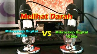 Perbandingan Pembesaran Darah Antara Mikroskop Digital 1000x vs Mikroskop Digital 1600 [upl. by Aneehsar]