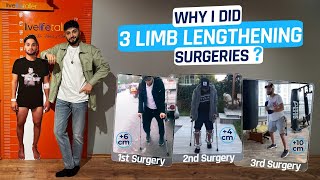 SEDAT WHY I DID 3 LIMB LENGTHENING SURGERIES [upl. by Boutis372]