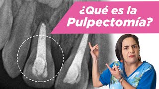 Pulpectomía ¿Qué es ¿Cuándo se debe hacer [upl. by Kleper]