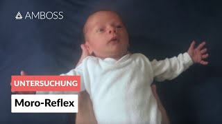 MoroReflex  Frühkindliche Reflexe  AMBOSS Video [upl. by Lordan504]