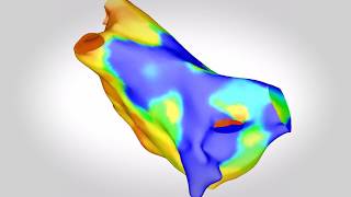 Cardiac Interventions Guys and St Thomas NHS Foundation Trust amp King’s College London [upl. by Pascal]