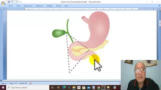 Pancreatic Disorders in Arabic 6  Zollinger Ellison Syndrome  by Dr Wahdan [upl. by Mikkanen]