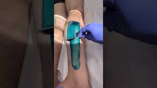 Professional lower leg wax using blue hard wax from Starpil hairremoval waxingexpert [upl. by Bigner439]