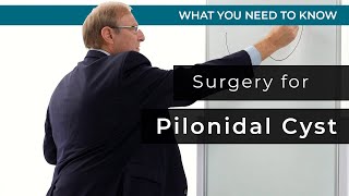 Surgery for Pilonidal Cyst [upl. by Retha420]