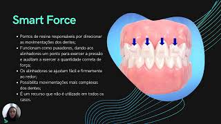 Biomateriais Tecnologia do Invisalign [upl. by Jacy]