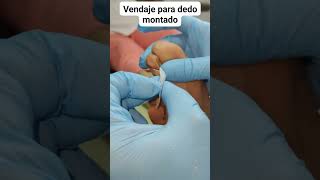 vendaje para dedo montado supraducto pie podologia vendaje podologo podiatrist [upl. by Leahcym]