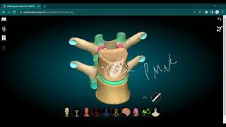 L6 Patho  Tuberculous Osteomyelitis [upl. by Amled]