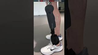 This guy gives people new legs shortsvideo [upl. by Akibma]