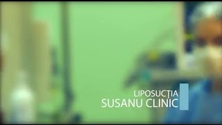 Liposuctie lipoplastie Susanu Clinic [upl. by Durham]