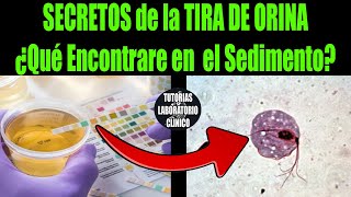 🔥 Descubre el SECRETO DEFINITIVO ¿Que Encontraré en el SEDIMENTO URINARIO según la TIRA DE ORINA🔬 [upl. by Danyelle522]