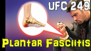 UFC 249 Will Dominick Cruzs Plantar Fasciitis be a Factor [upl. by Ahseuqram]