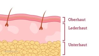 Wie entsteht Neurodermitis  NetDoktorde [upl. by Ylrae435]