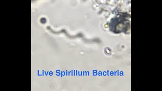 Spirillum Bacteria [upl. by Ardnauqal]