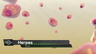 Living with herpes [upl. by Eniaral]