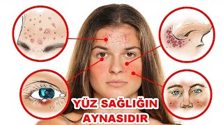 Yüzünüzün Sağlığınız Hakkında Söyleyebileceği 18 Şey [upl. by Rosamund]