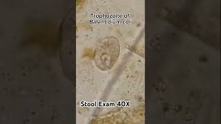 Balantidium coli trophozoite  Protozoa  stool examination 40X  shorts [upl. by Ailuj]