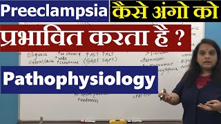 Preeclampsia Pathophysiology in Hindi हिंदी  Pregnancy induced Hypertension  Nursing Lecture [upl. by Aicen]