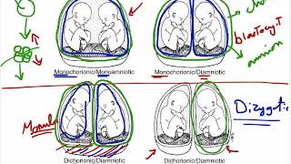 multiple pregnancy [upl. by Enoj]