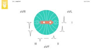 Die Bestimmung des Lagetyps im EKG [upl. by Berstine]