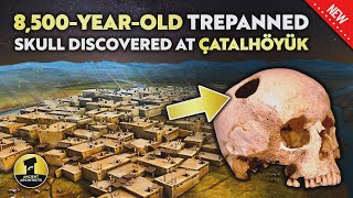 8500YearOld Trepanned Human Skull Discovered at Çatalhöyük  Ancient Architects [upl. by Paul]