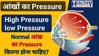 iop  आंखों का प्रेशर क्या होता है  Intraocular pressure  Glucoma in eye  काला मोतिया [upl. by Ettesel539]