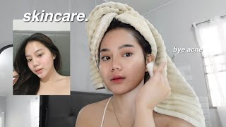 how i cleared my ACNE  my skincare routine affordable [upl. by Ettenav]