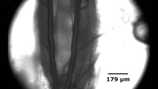 Quantification of Drosophila Larva Heart Function Using Microfluidics by Alireza Zabihihesari [upl. by Dietsche]