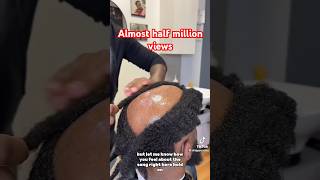 Wig Installation For Men 😱hairstyles baldisbasics shortsviral millionviews fypシ゚ [upl. by Debora]