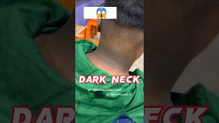 Dark Neck Home Remedy  Get Rid of Dark Neck  Dark Hands  Dark Elbow  Dark Feet  Remove Body Tan [upl. by Tiffany]