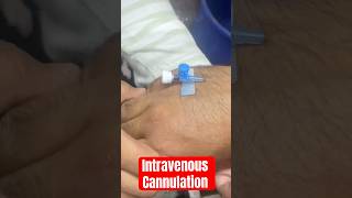 ivcannulation intravenous intravenouscannulation subscribe SMpharmacy follow rap [upl. by Hermione]