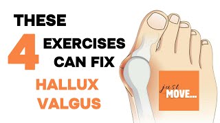 Hallux Valgus Exercises  no equipment  follow along  building up the arch of the foot [upl. by Kowtko]