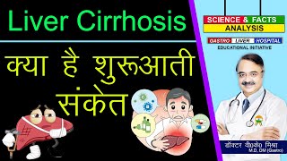 Liver Cirrhosis क्या है शुरुआती संकेत   CIRRHOSIS OF LIVER [upl. by Odlaw]