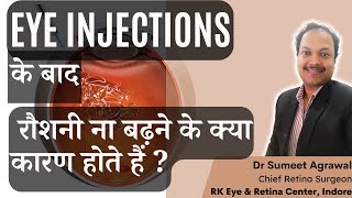 EYE INJECTION के बाद क्या रौशनी नहीं बढ़ी  जानिये इसके कारण [upl. by Sternick]