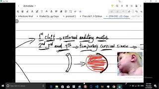 Lecture 1  Endocrine System  Thyroglossal Duct and Pharyngeal Cleft Cysts  USMLE STEP 1  Arabic [upl. by Ulises486]