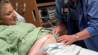 Maternity Fetal Monitoring [upl. by Enialed267]