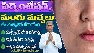 Home Remedies for Pigmentation  How to Remove Mangu Machalu  Dr Manthena Satyanarayana Raju Videos [upl. by Etnad106]