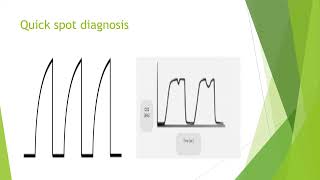 Capnography in Anaesthesia and Critical Care [upl. by Morette386]