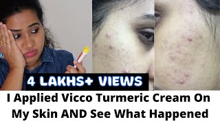 ❌🔴 I Applied Vicco Turmeric On My Skin amp See What Happened  Side Effects Of Vicco Turmeric Cream [upl. by Haman950]