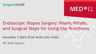 Endoscopic Stapes Surgery Pearls Pitfalls amp Surgical Steps Using Clip Prosthesis  SurgeryONLINE [upl. by Mian]