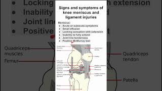 Signs and symptoms of knee meniscus and ligament injuries [upl. by Eimaraj]