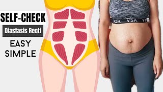 Super Simple SelfCheck Diastasis Recti both gap and depth [upl. by Nnalorac]