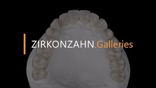 Complete restoration made with Prettau® 4 Anterior® zirconia  ZirkonzahnGalleries [upl. by Singer702]