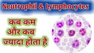 Neutrophil high Causes  Lymphocytes high Causes  Low Neutrophil  Low Lymphocytes [upl. by Valenba]