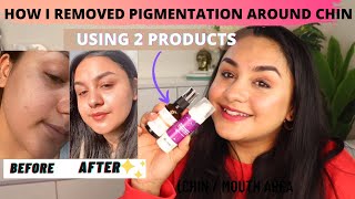 How I Reduced Pigmentation Around My ChinMouth By Using Only 2 Products [upl. by Delle]