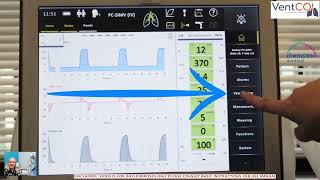 Stopping Ventilation Tutorial  Elisa ICU Ventilator [upl. by Aniratac]