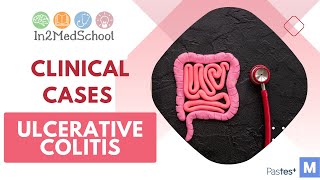 Ulcerative Colitis Clinical Case [upl. by Sitoiyanap332]