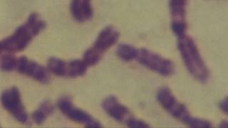 Cytogenetics Human chromosomes Karyotype [upl. by Gold]